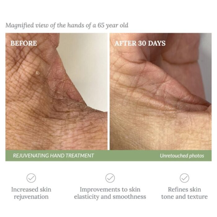 reerth rejuvenating hand treatment 230801042931 2