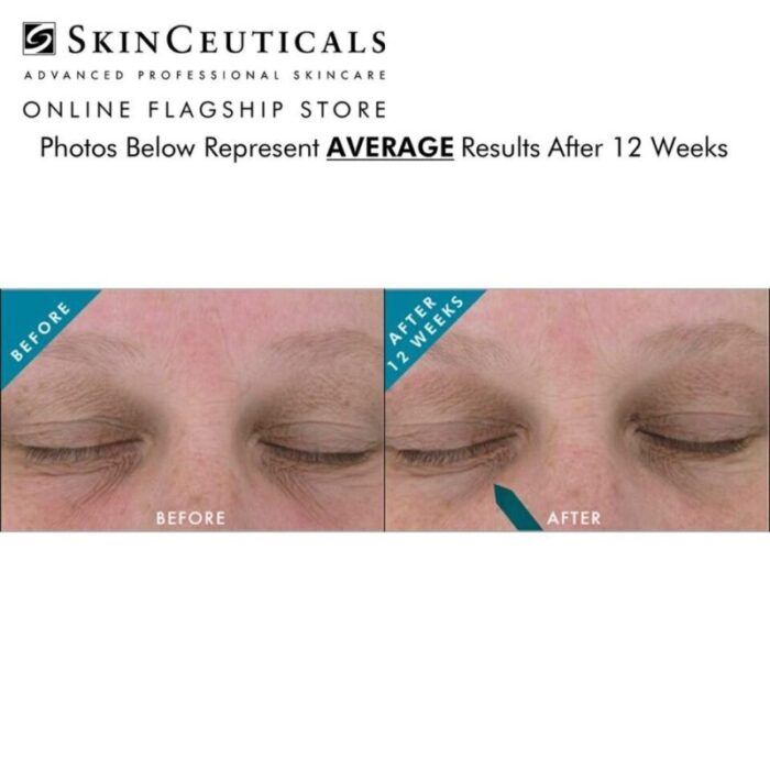 skinceuticals aox eye gel 241010021412 2