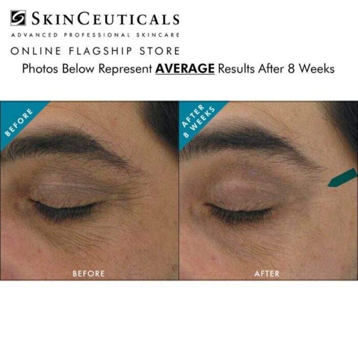 skinceuticals aox eye gel 241010021412 3