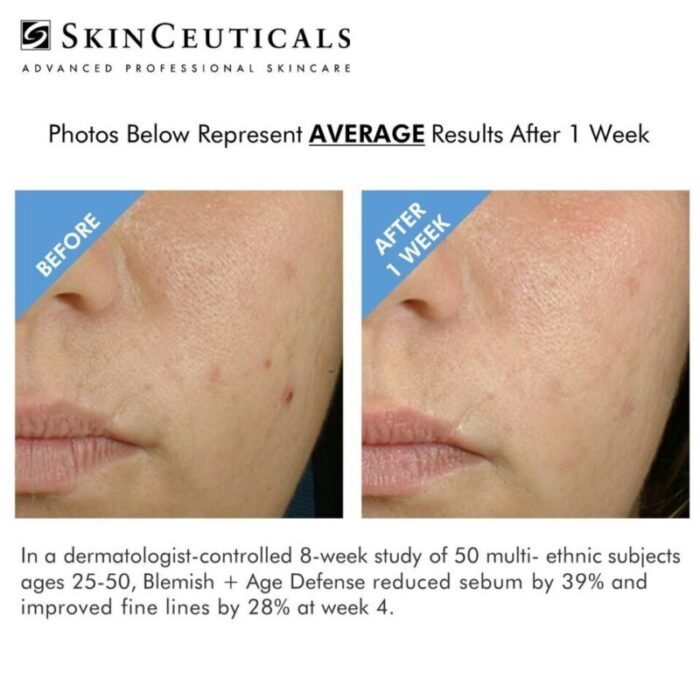 skinceuticals blemish age defense 240918043517 2