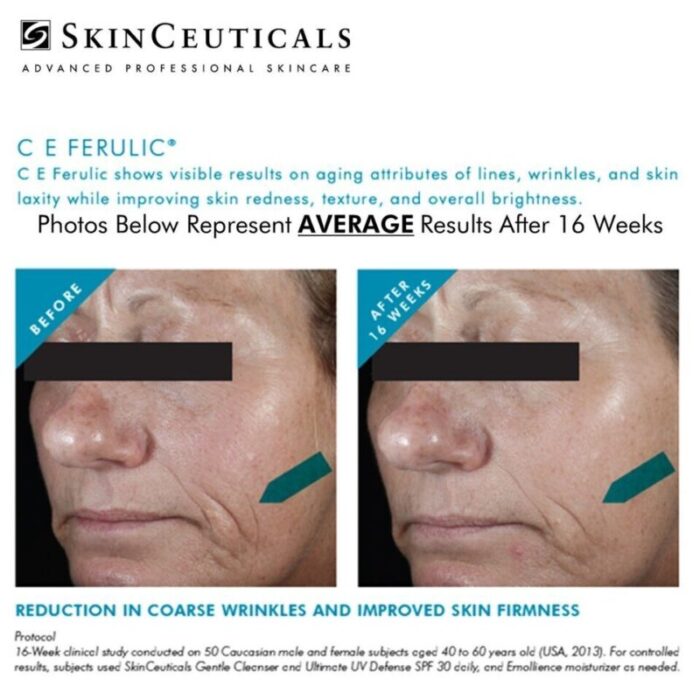 skinceuticals ce ferulic 240918043845 3