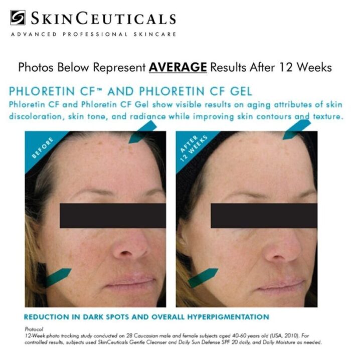 skinceuticals phloretin cf 240710095343 4